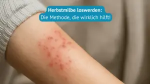 herbstmilbe
