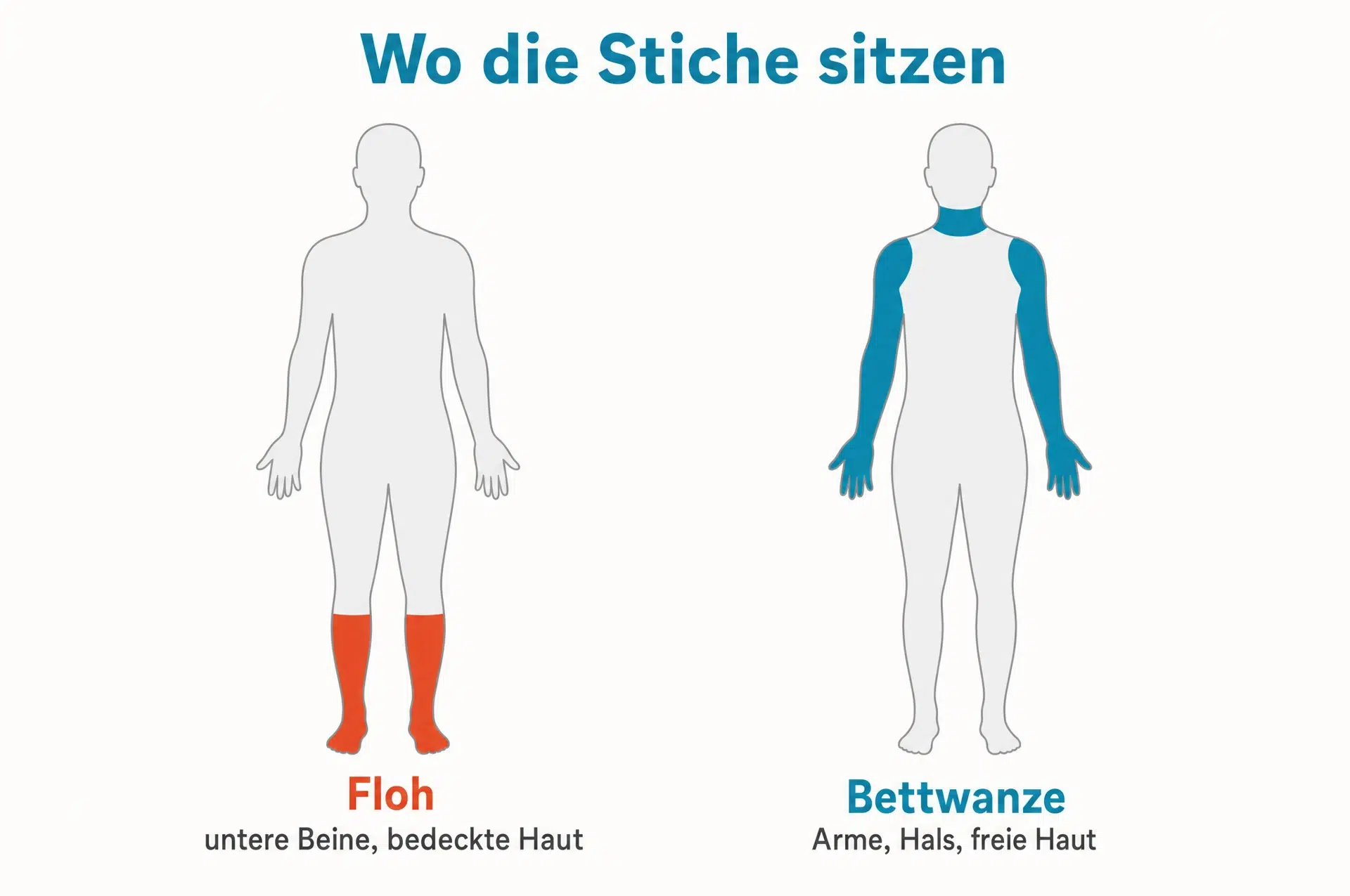Flohbisse oder Bettwanzenstiche: Flohbisse sitzen an den unteren Beinen, Bettwanzenstiche an Armen und Hals